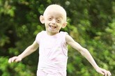 英国女孩埃利奥特在一岁时就被诊断患上早衰症，她今年7岁，看上去却像是一名老人了，且皮肤看上去呈淡绿色。
医生称，她的衰老速度比常人快8倍，这意味着当她10岁时，实际外貌是80岁的老太太了。
