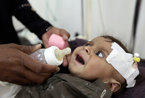 也门近百万儿童遭受营养不良