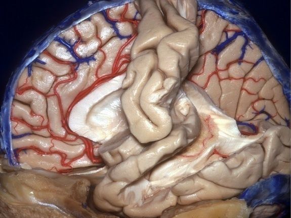 胆小慎入:人类大脑的三维解剖图