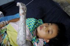 6岁女童冲进火海救妈妈 