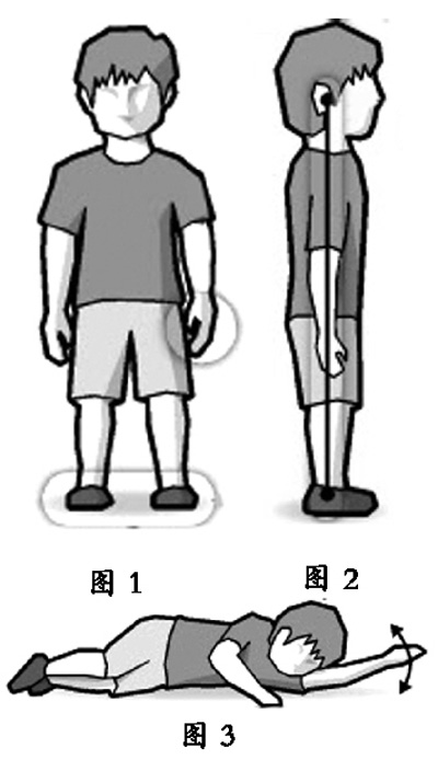 站姿不对或关节出问题轻则易疲倦严重会摔跌