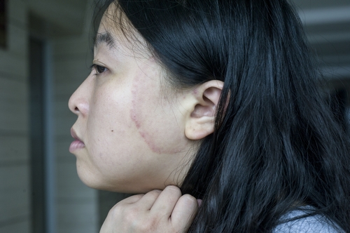 湖南：女子用iPhone5S打电话脸遭“电辐烫伤”(图)