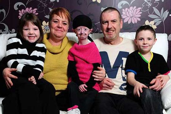 衰老速度比常人快8倍英国&ldquo;百岁少女&rdquo;离世（图）