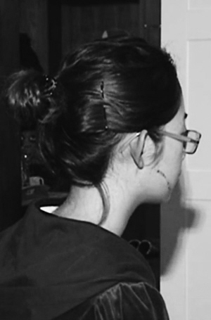 复旦女生当街被划脸缝7针