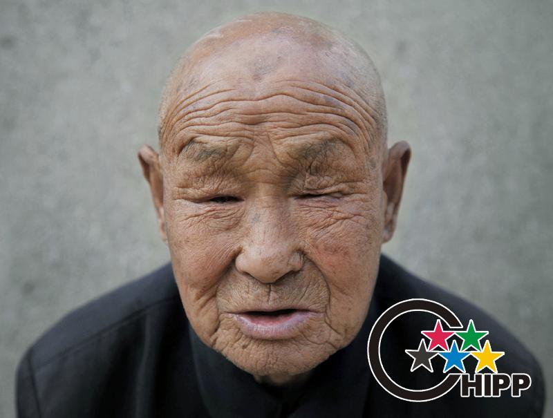 心富,88岁,中国山东省高密市人,1944年至1945年日本三菱矿业劳工 ,双眼视力丧失。(2010年10月3日摄)