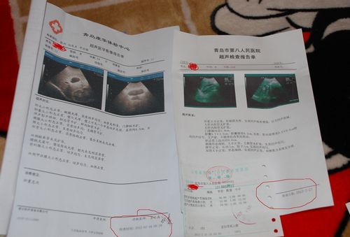 医生开药方用暗号 需指定药店才能破译(图)