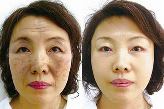 <em>女人更年期症状</em>,晒一下快速解决方法【100%有