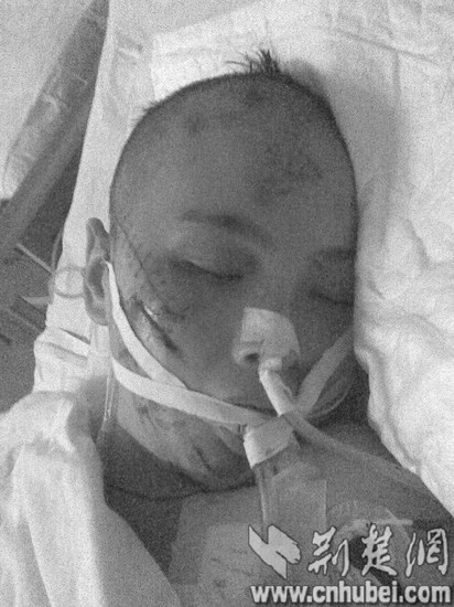 图为:如今躺在病床上的石玉霞仍未苏醒