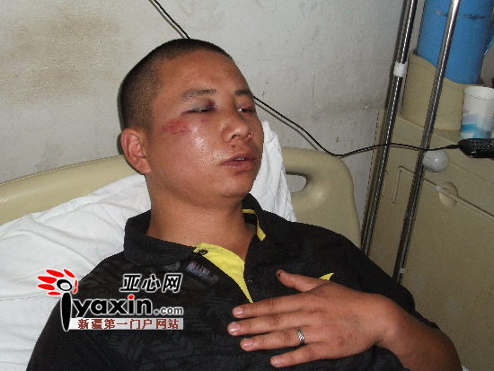 受害人杨周，眼部、脸部青肿，他胸部很痛痛苦地用手捂住胸口。