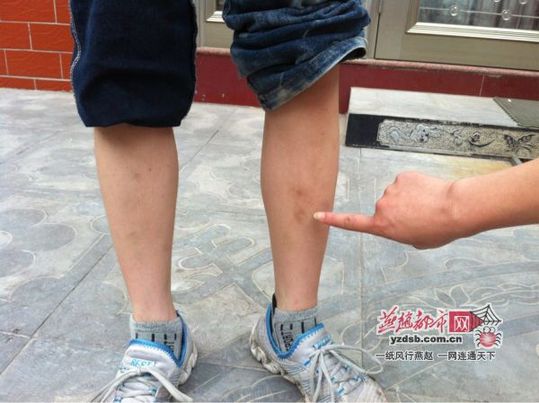 沙河13岁男孩屡遭班主任体罚 母亲无奈发帖寻