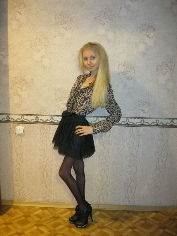 减肥达人:俄罗斯女孩惊悚瘦身照