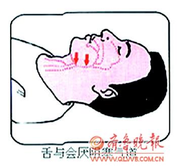 　　開通氣道:仰頭舉頜(頦)法,先清理口腔異物(嘔吐物、血塊等)去掉假牙,一手食指、中指置於下頦處,抬起下頦,使頭後仰,一手托頸後,頭後仰的程度以下頜和耳垂的聯線與地面垂直為宜,後仰不要過度。