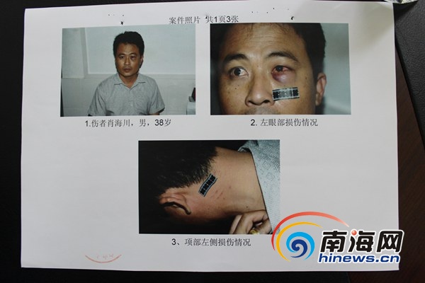 　　肖某为轻微伤(实习生毛亚晶摄)