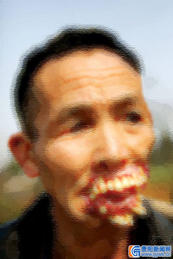 老人讲述狼嘴逃生经历:面部毁容口罩遮面53年