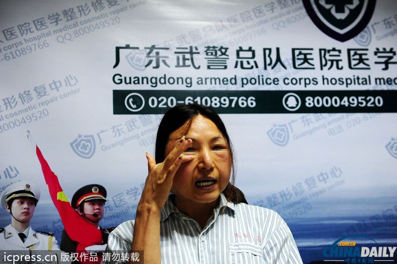 <em>广州一</em>妙龄<em>打工妹</em>小诊所丰脸失败变老太婆_