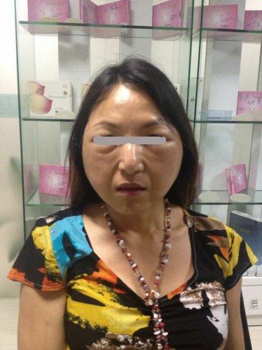 整形后的小莲貌似老太婆src="http://y2.ifengimg.com/news_spider/dci_2013/09/2f2f351fc03d4eb097391f89364d946e.jpg"