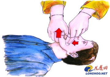 急救法海姆立克婴儿 452c90f222c05ed5e82b934e1472894f.jpg