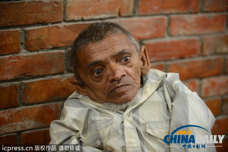 尼泊尔老翁身高仅41厘米 或成“世界最矮”(图)