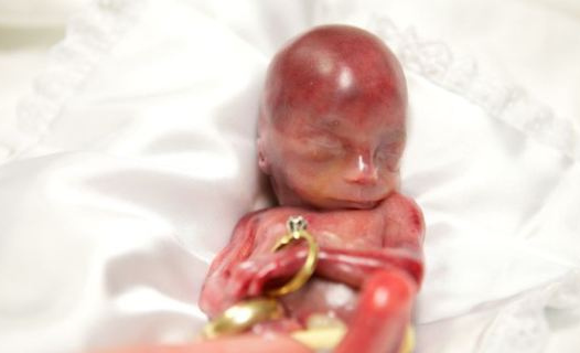 怀孕19周胎儿图图片