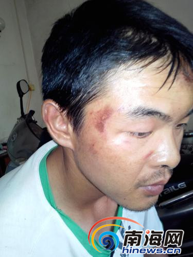 三亚市民称围观拆迁时无故遭十几名执法人员群殴