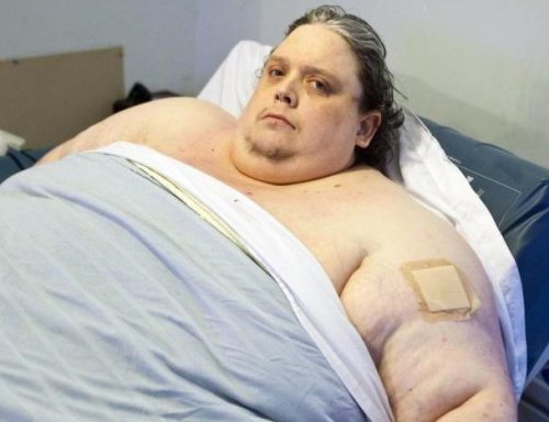 全球第一肥男735斤10年未出门