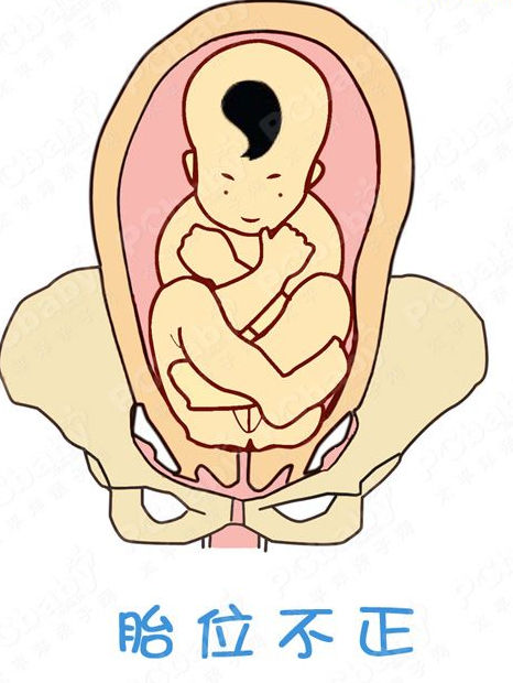 胎儿姿势看男女 肚子图片