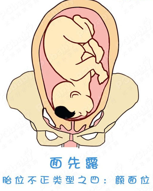 怀孕七个月胎儿姿势图图片