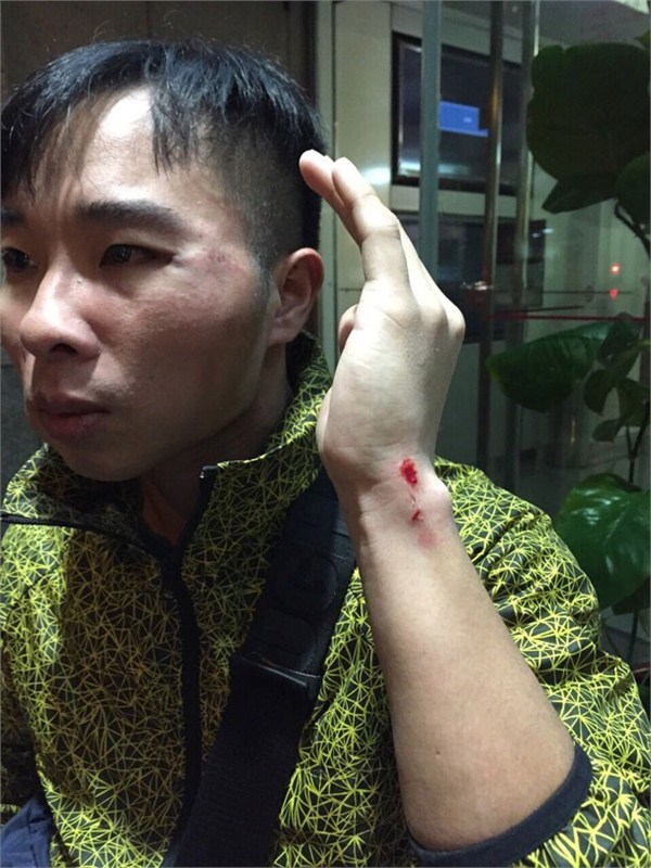 香港警察被当街殴打受伤 嫌犯称"我是占中的"(图)