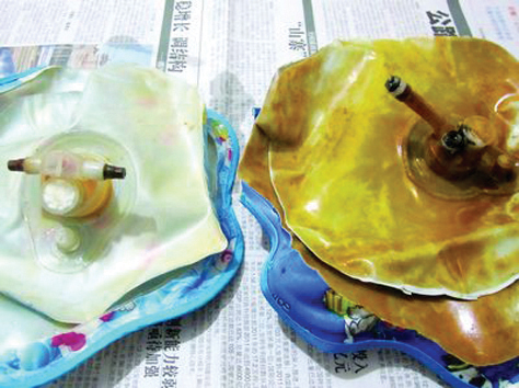 315晚会曝光部分暖手宝易爆炸有人脸被炸伤