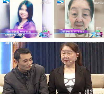 28岁女子患罕见皮肤松弛怪病 "一夜"变老妪
