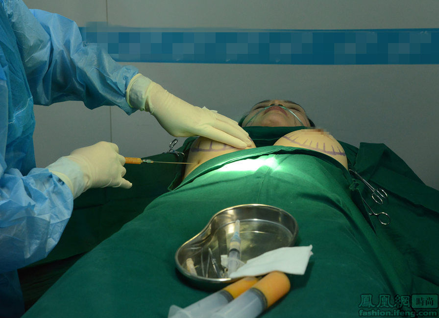 台艳星来京整形放言胸部可任摸