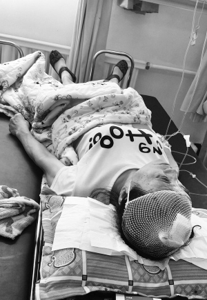 旋转吊扇坠落砍伤老妇头部