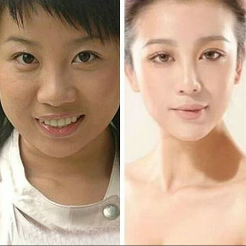 网曝歌手阿宝老婆近照 前后对比明显疑整容|张冬玲|网友_凤凰娱乐