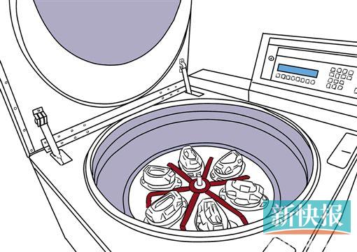 美国axp脐带血自动分离装置,置于低温离心机中即将进行脐带血造血干