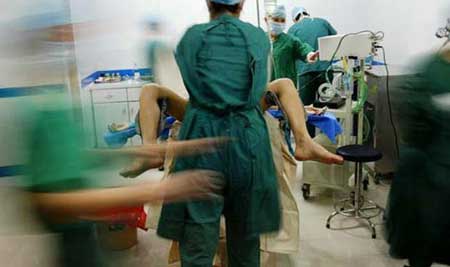 变性手术实拍器官图片