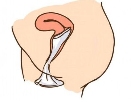 演示女性避孕套的操作使用方法组图