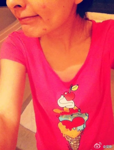 吴昕皮肤堪忧晒微博自制祛痘面膜秒杀痘痘