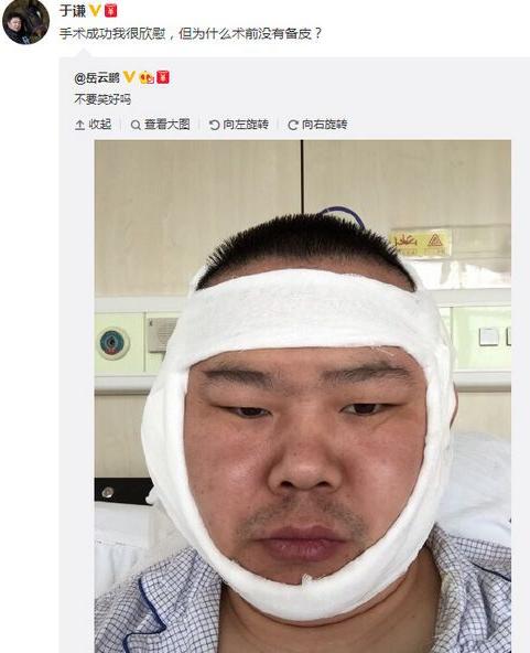 照片中,因为刚刚进行过手术,岳云鹏的面部有些肿胀.