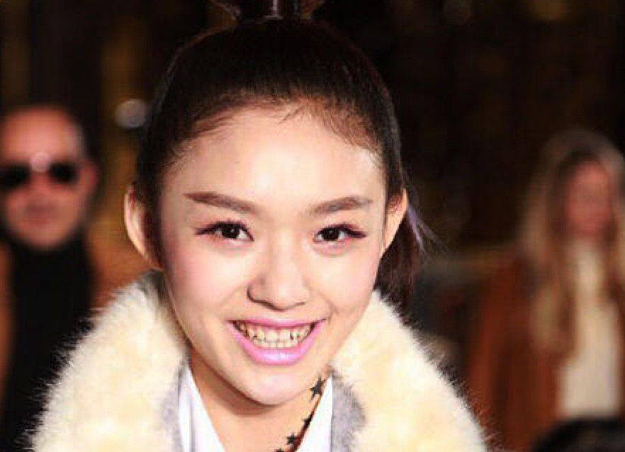 林允牙黄遭尴尬,唯爱牙齿冷光美白仪可解围