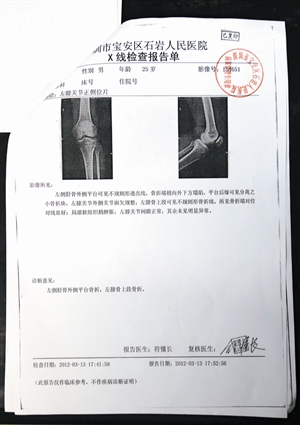 小腿骨折报告单图片