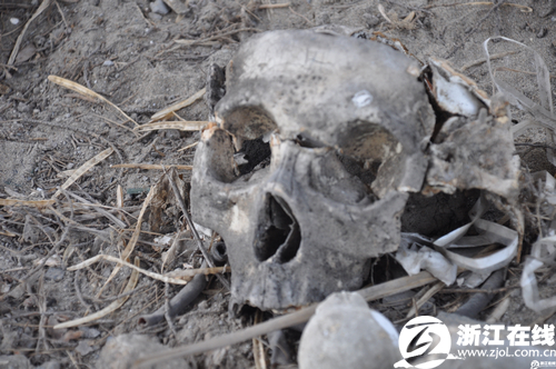 余杭惊现白骨吓坏村民原来是实验里的石膏标本